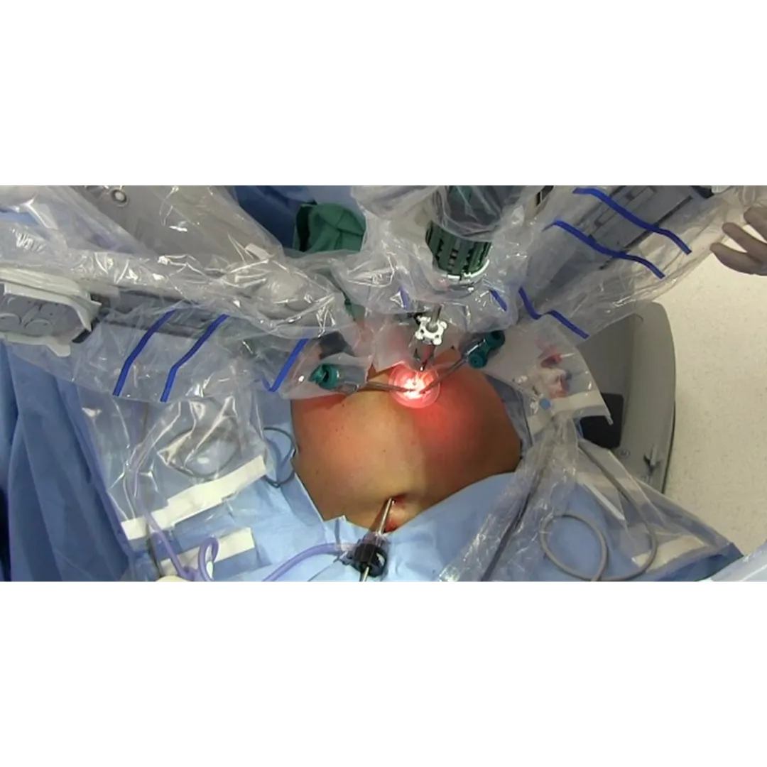 Effective GERD Relief Through Robotic Hiatus Hernia Surgery Near Dasarahalli – Trusted Care