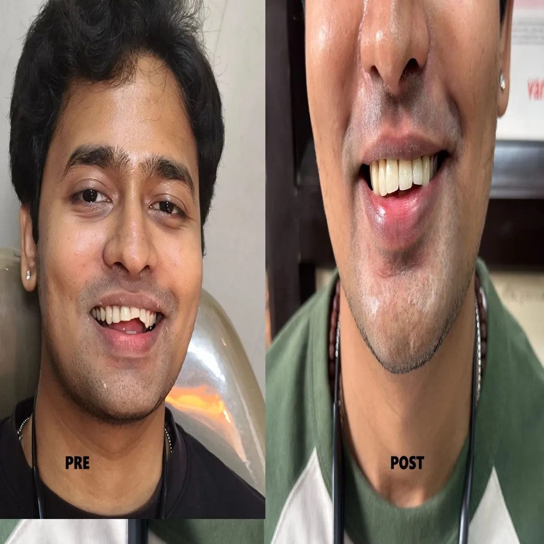 Smile Designing Dentist in Greater Noida West – Perfect Your Smile with Expert Care