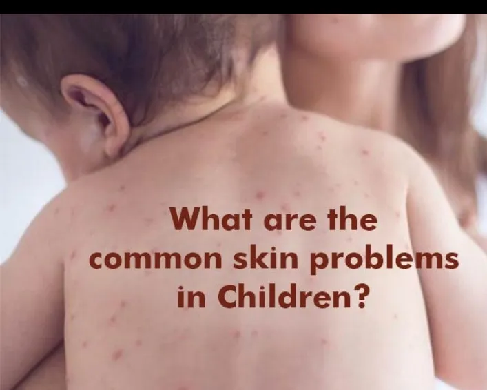 From Rashes to Relief By Child Dermatologist Dr Bhagyashri, Kalloes Clinic, Hiranandani Estate Thane
