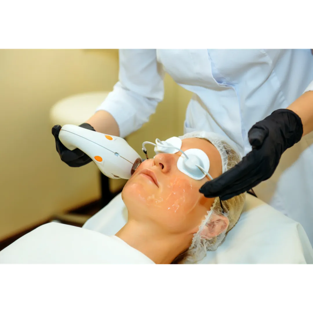 Photofacial in Nashik for Clear, Spot-Free Skin