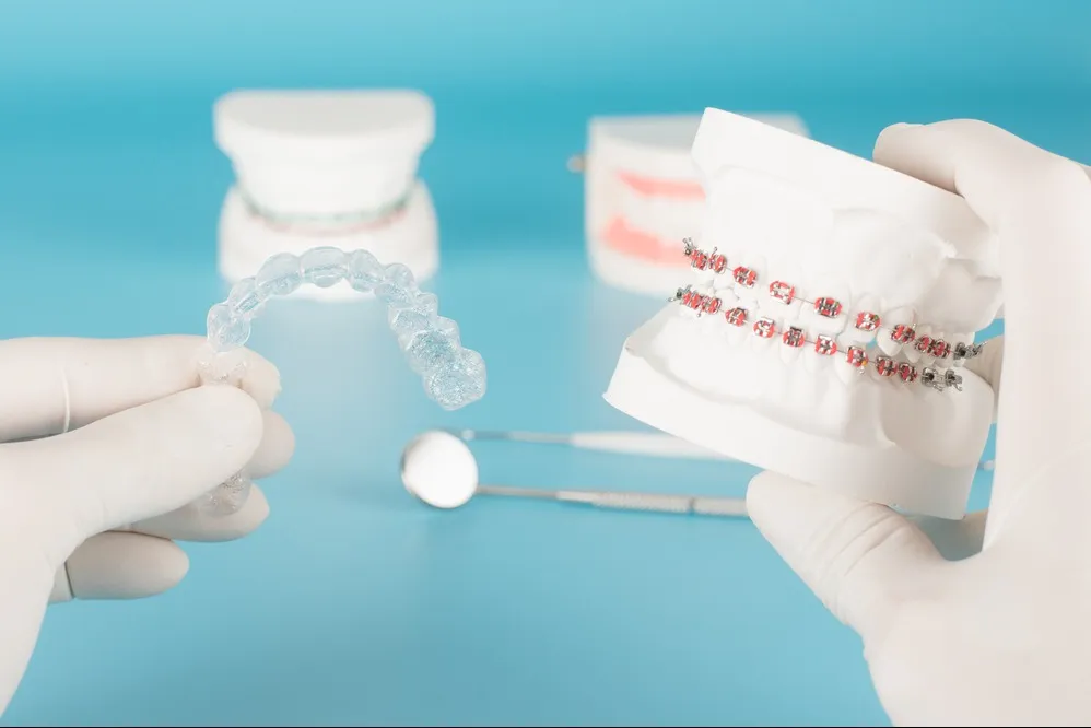 Fixed and Removable Orthodontic Therapy in Hyderabad – Choose What Suits You