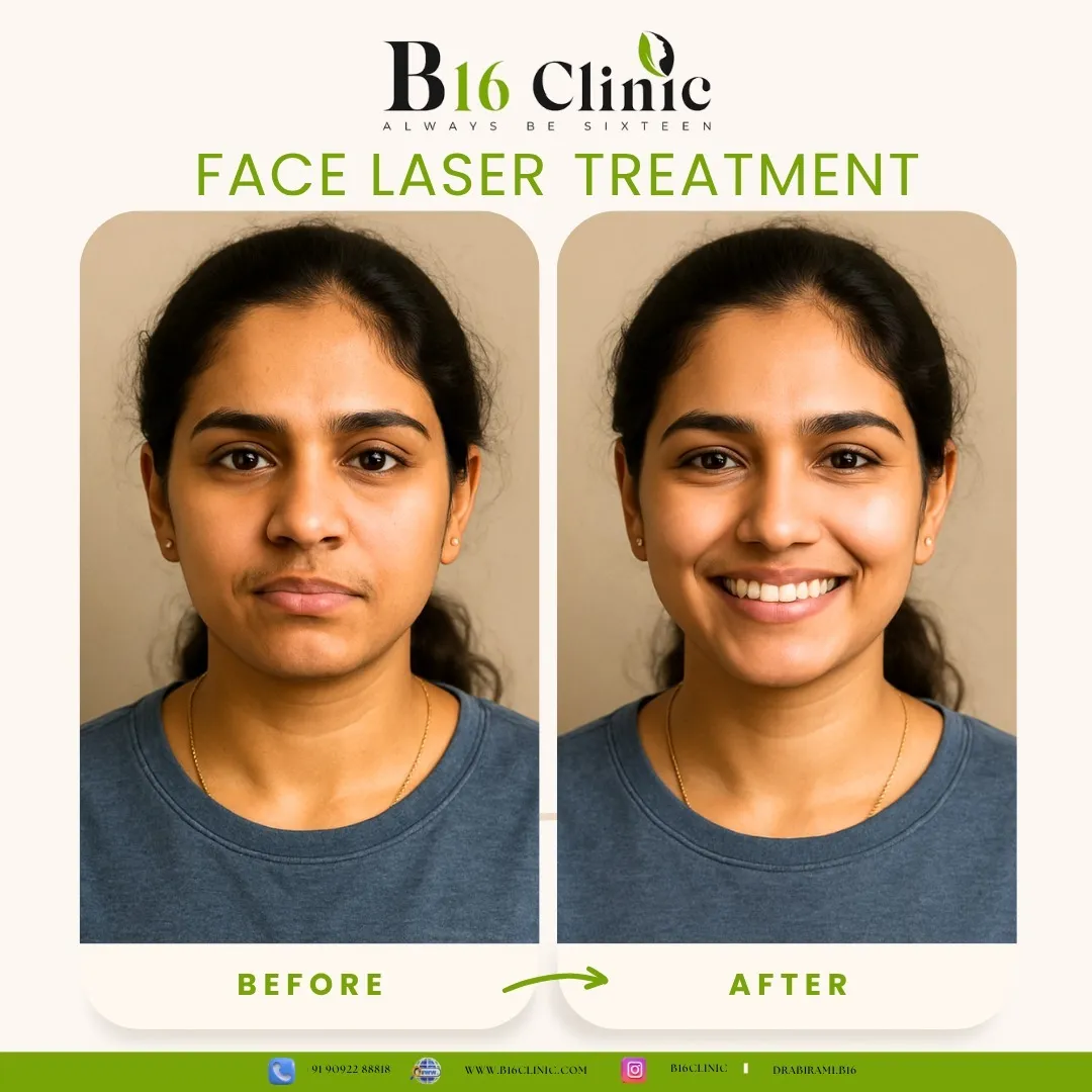 Face Laser Treatment in Coimbatore – At B16 Clinic