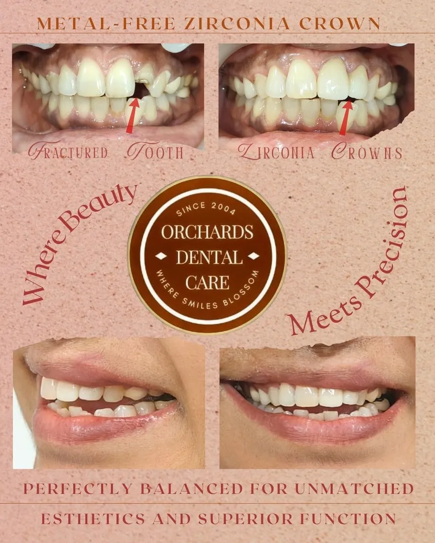 Where Beauty Meets Precision ✨ Your Guide to Perfect Teeth !!