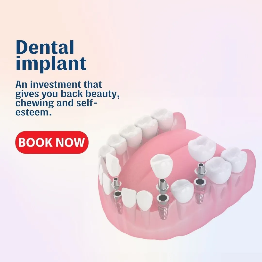 Best Implantologists in Dhule | Dental Implants at Gindodia Hospital