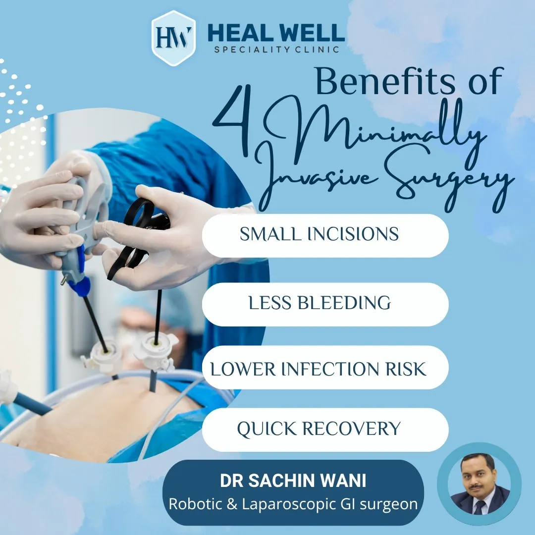 Benefits of Minimally Invasive Surgery in Thane