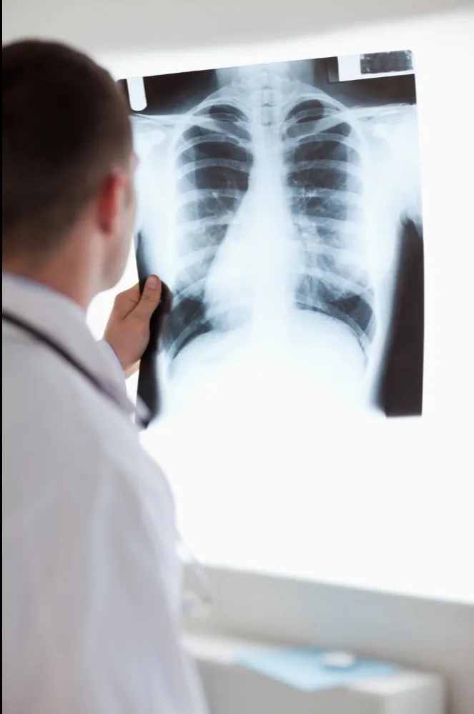 X-Ray in Thane – Fast, Accurate Imaging