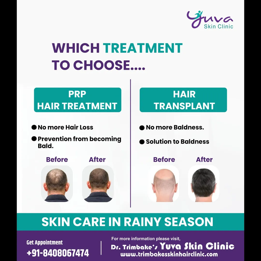 Not sure which treatment is right for you? 🤔
🔹 PRP Hair Treatment – Prevents hair loss & keeps you...