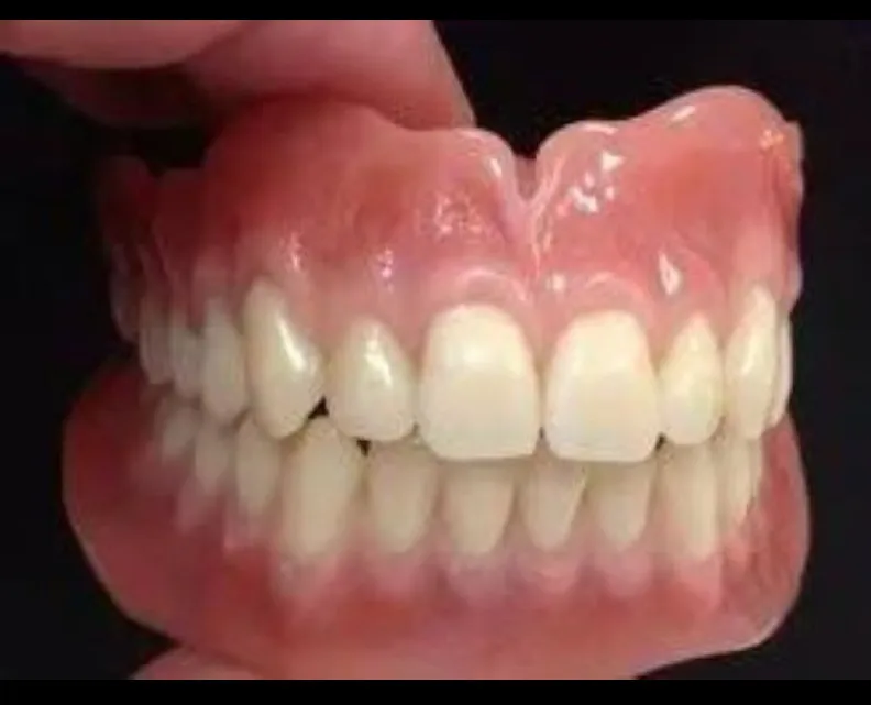 Full Mouth Rehabilitation in Greater Noida West – P.D. Dental