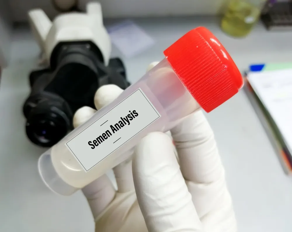 Semen Analysis in Parel – Essential Testing for Fertility Clarity