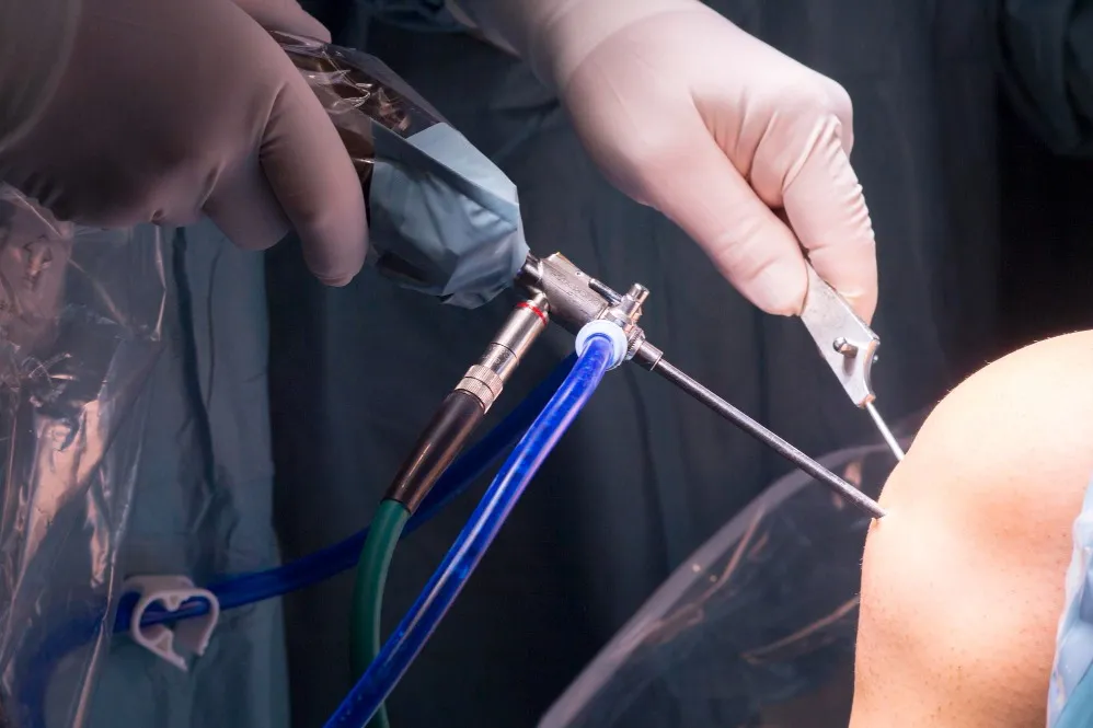 Precision Meniscus Surgery in Noida for Lasting Knee Health