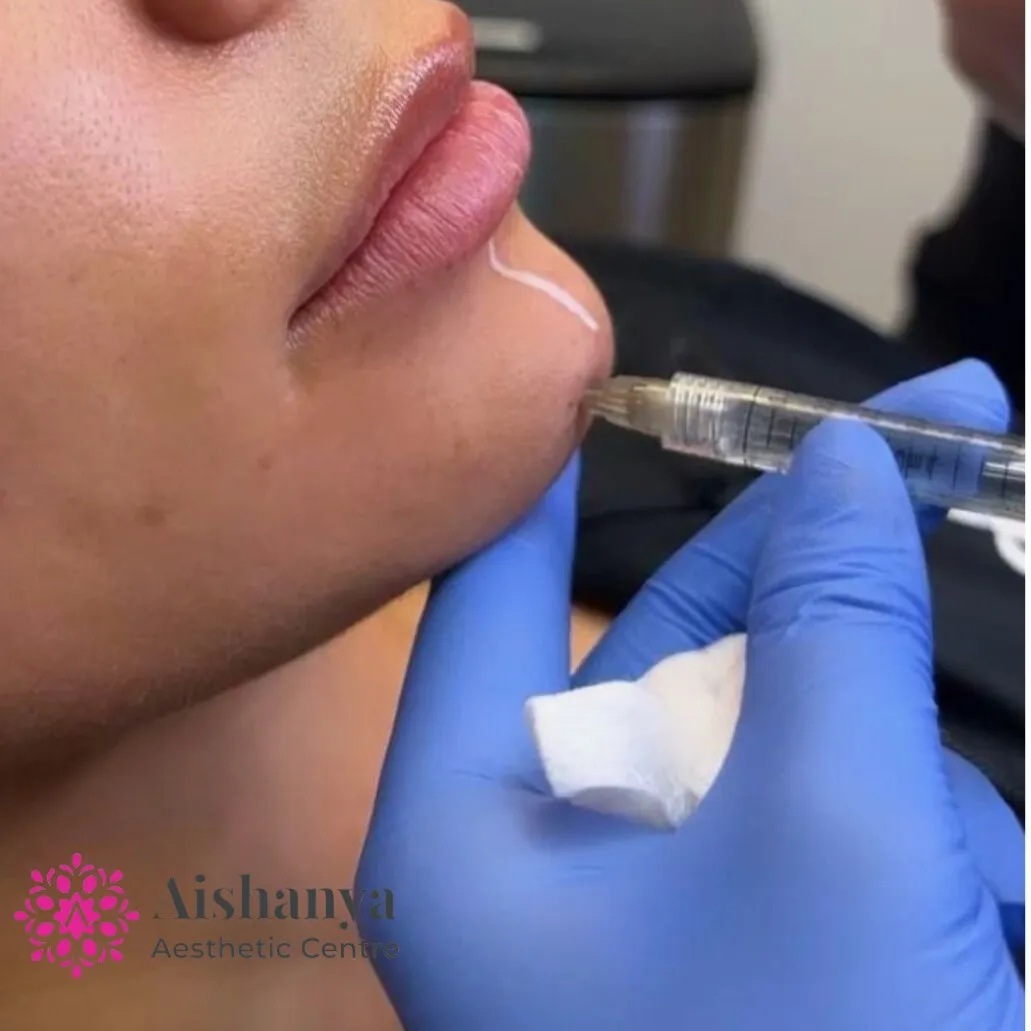 Best Filler treatment in Dwarka