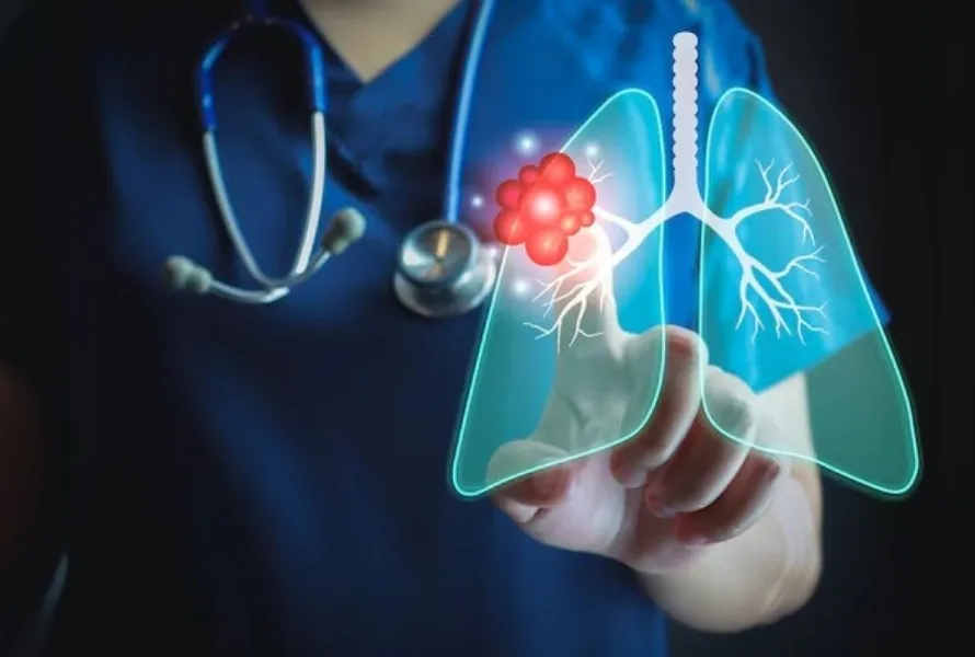 Lung Cancer Specialist in Jaipur – Early Action Saves Lives