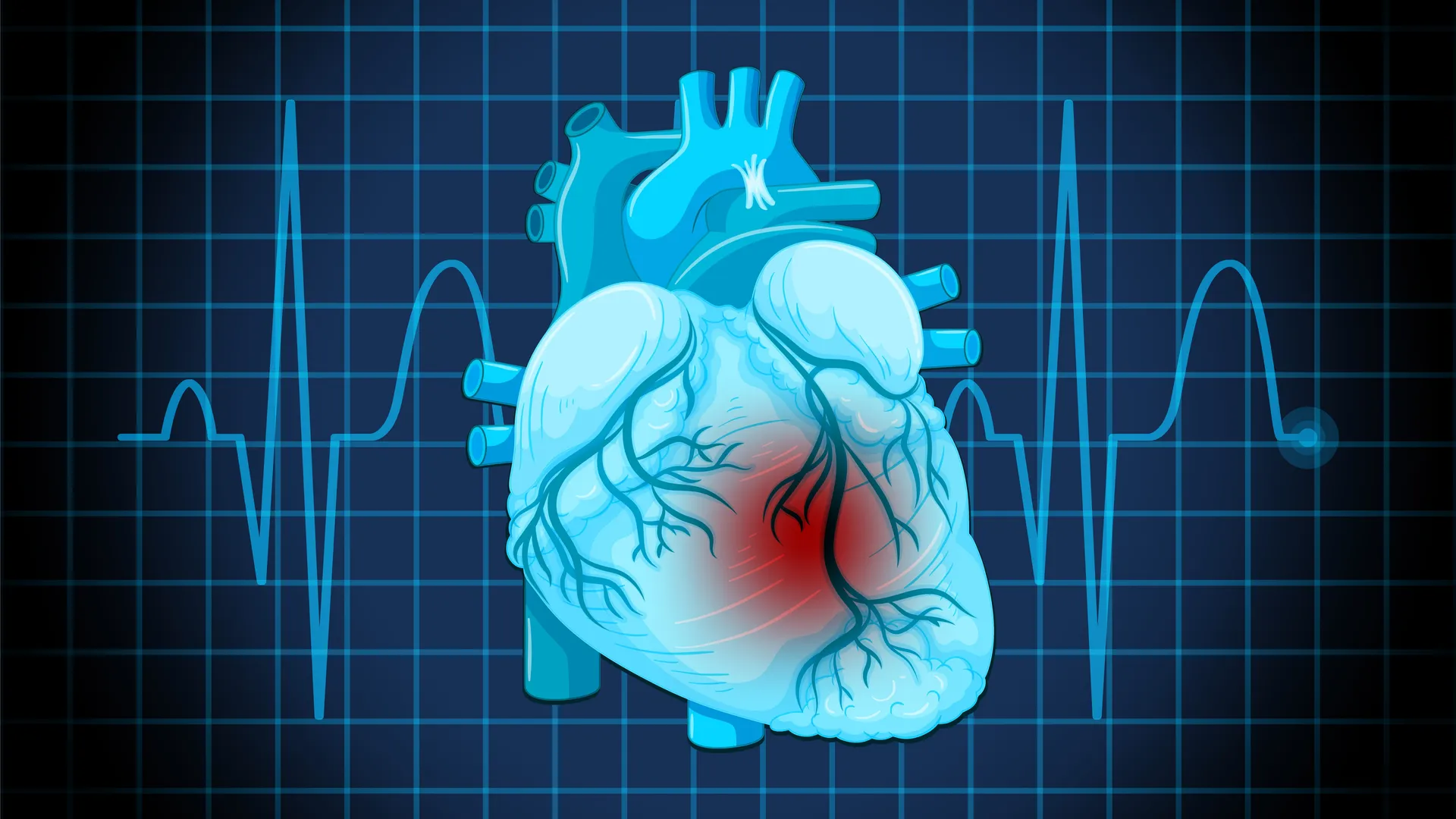 TAVR in Aundh – A Modern Alternative to Open-Heart Surgery
