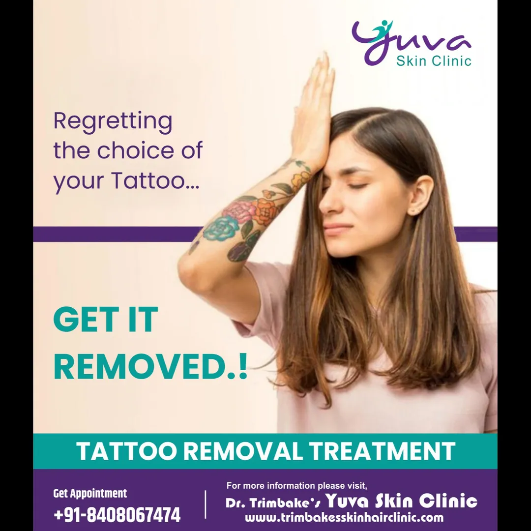 Tattoo Removal Treatment
Getting bored of your permanent tattoo... Want to get a new tattoo inked on...