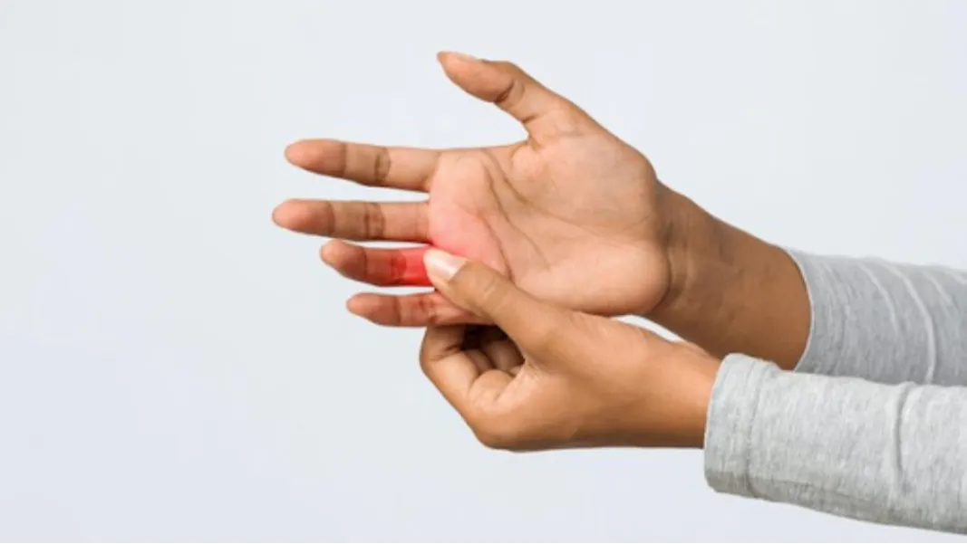 Trigger Finger Release Operation in Bangalore – Quick Relief for Locked Fingers