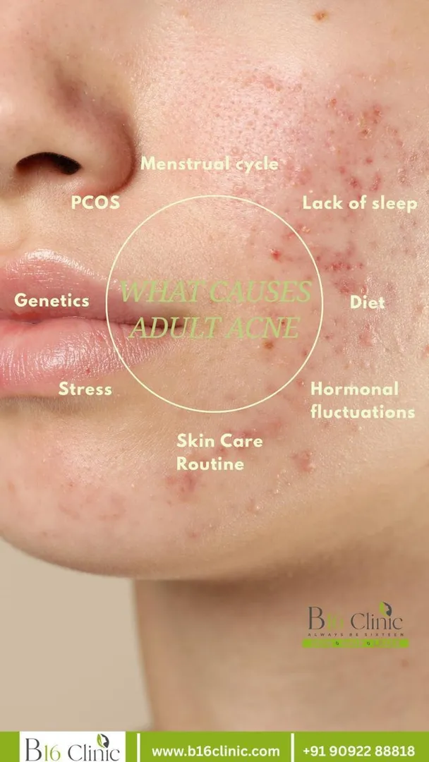 ✨ Clear, Healthy & Confident Skin with B16 Clinic – Coimbatore ✨