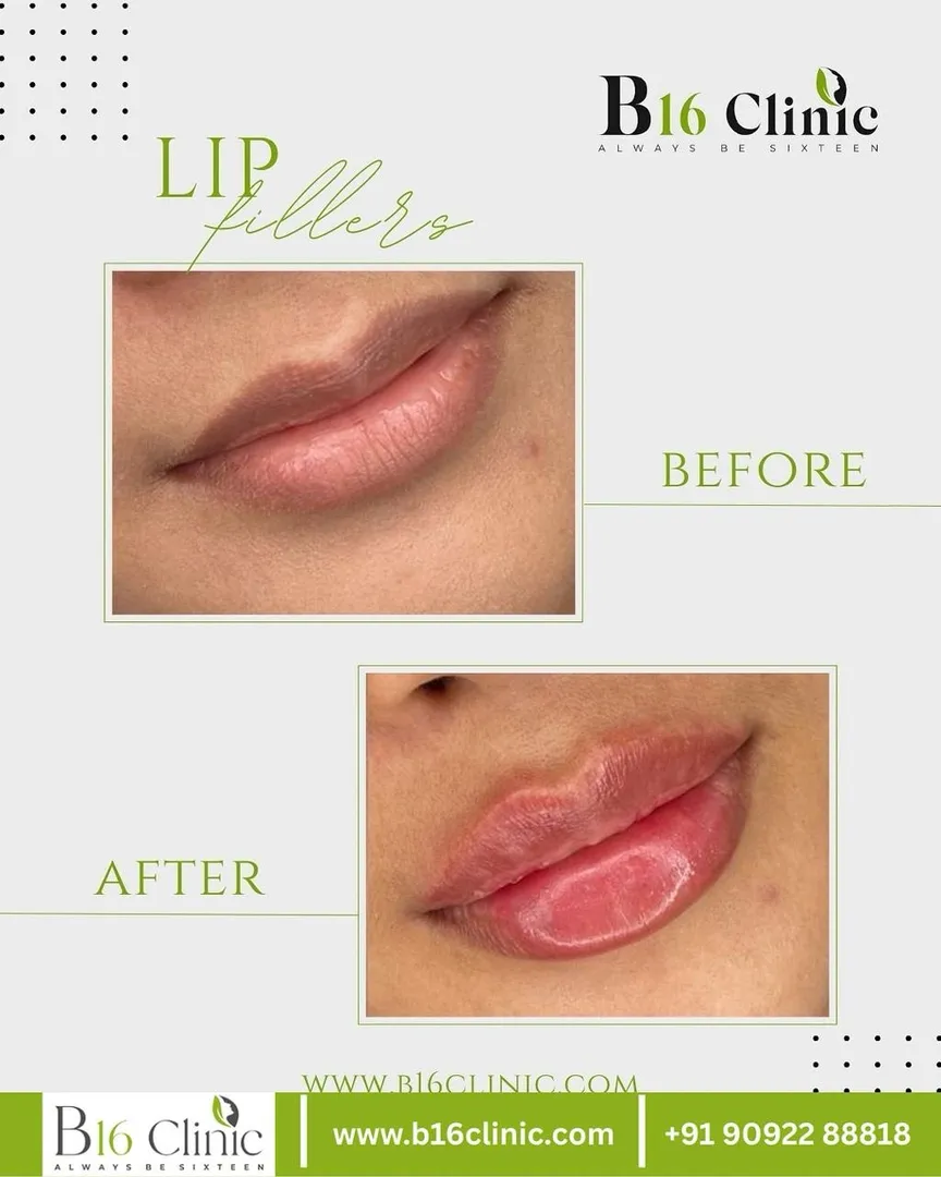 B16 Clinic – Advanced Lip Pigmentation Treatment in Coimbatore
