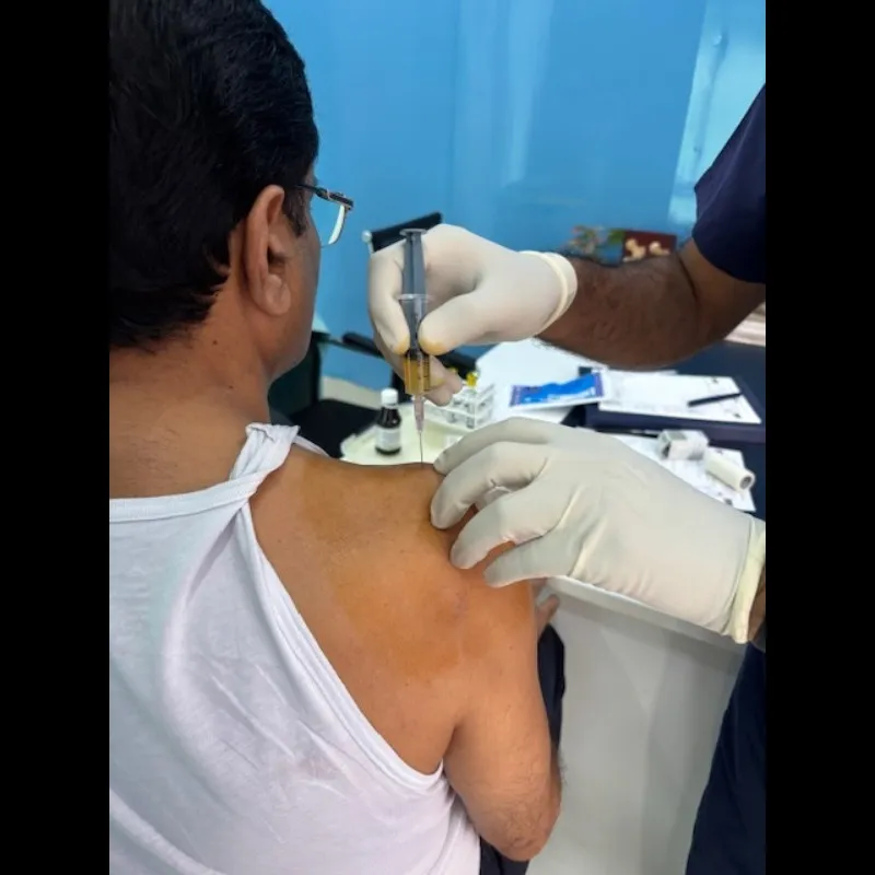 GFC INJECTION FOR SUPRASPINATUS TENDITIS (PARTIAL TEAR)