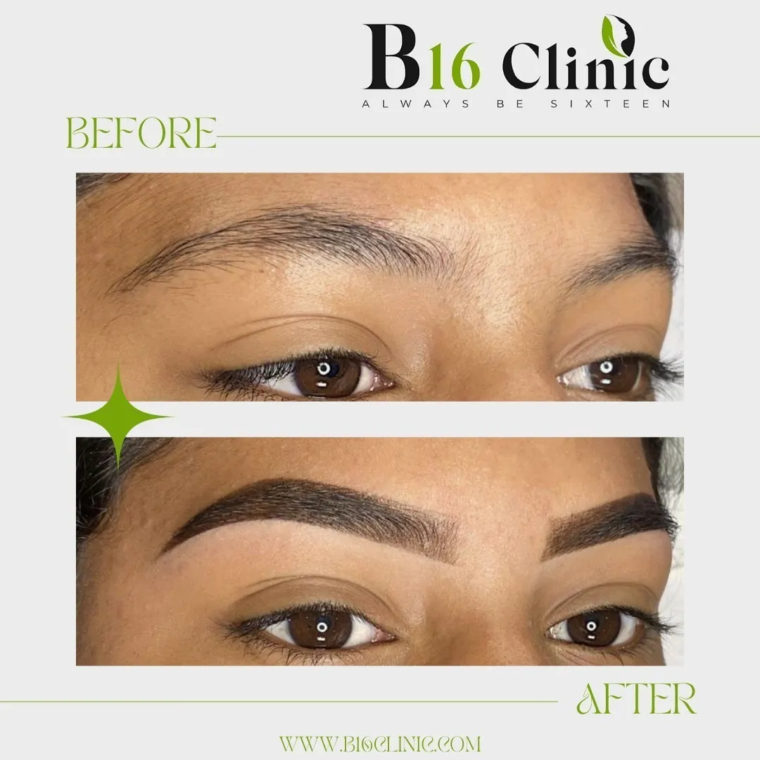 B16 Clinic – Microblading Treatment in Coimbatore