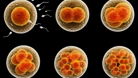 The IVF Process – Step by Step