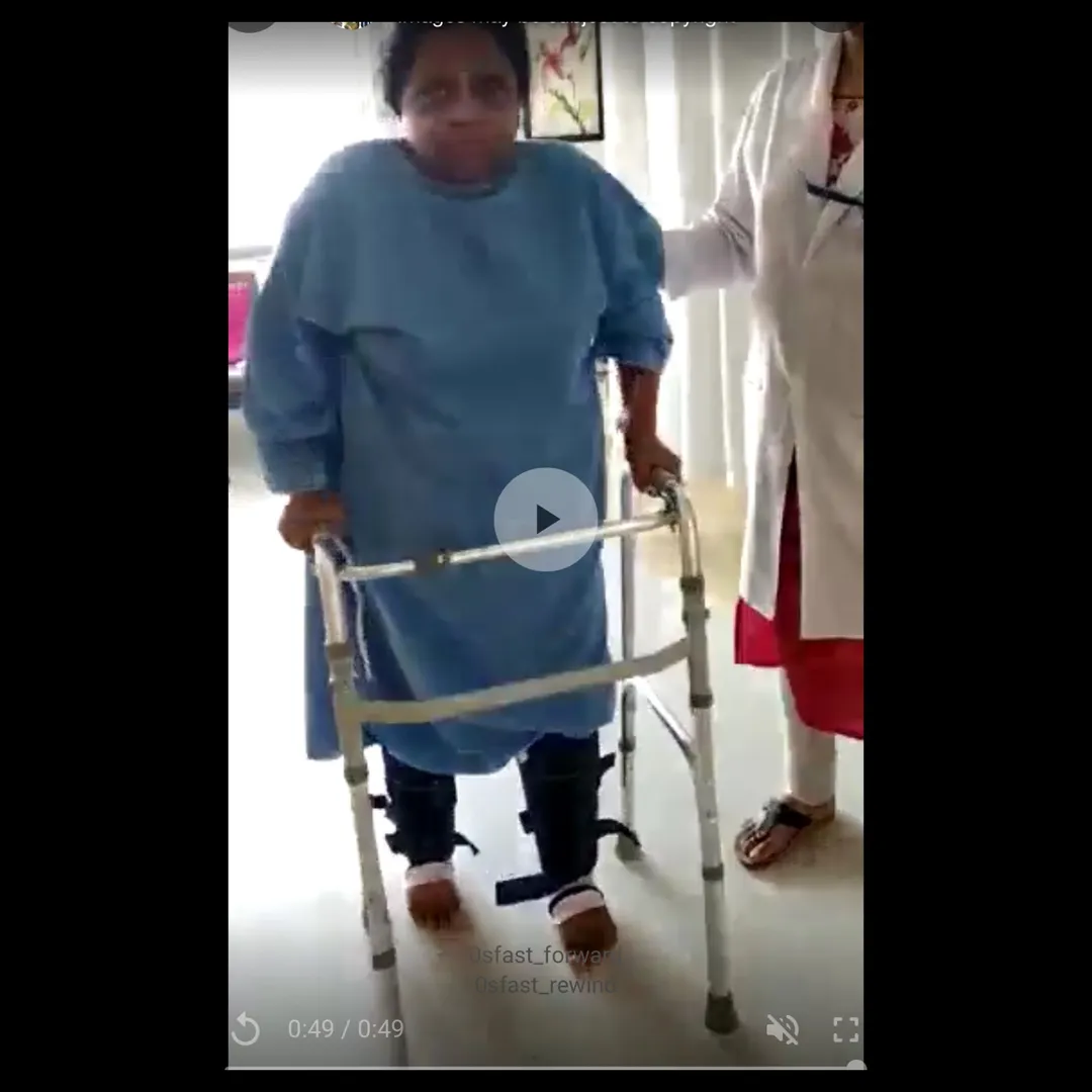 BILATERAL TKR SURGERY PERFORMED SUCCESSFULLY