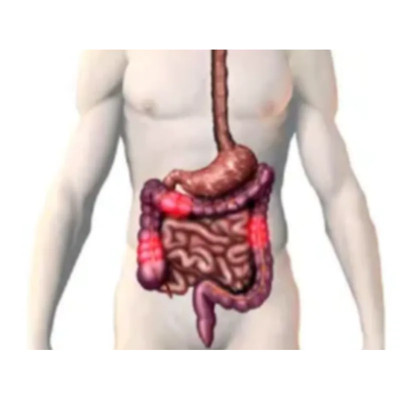 Chronic Diarrhoea Evaluation in Mumbai
