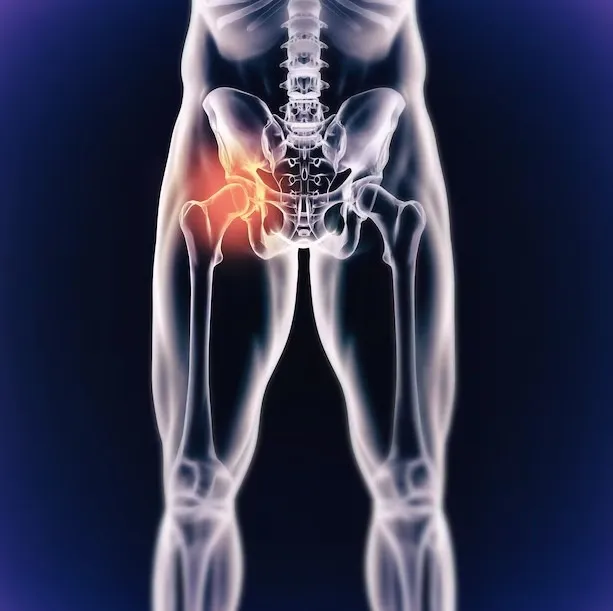 Managing AVN Symptoms in Nagpur
