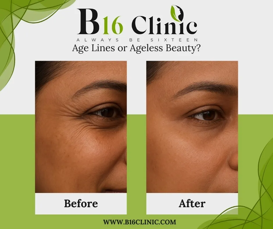 β¨πΈ Wrinkle-Free, Confident You β with B16 Clinic ! πΈβ¨