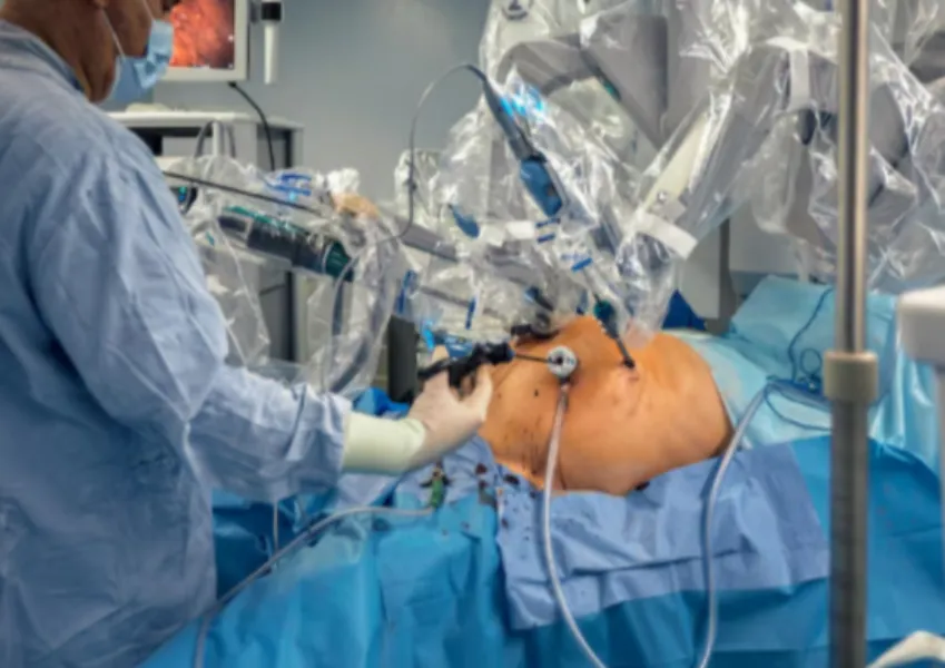 Robotic Rectal Cancer Surgery in Peenya – Targeted Precision for Complex Care