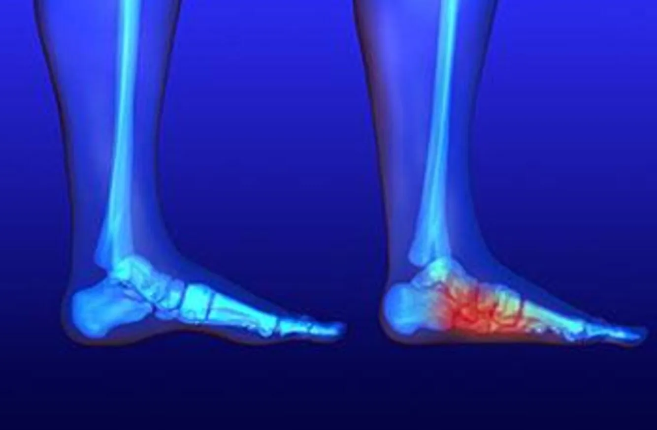 Deformity Correction in Pimpri-Chinchwad