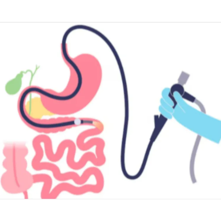 Double Balloon Enteroscopy in Mumbai