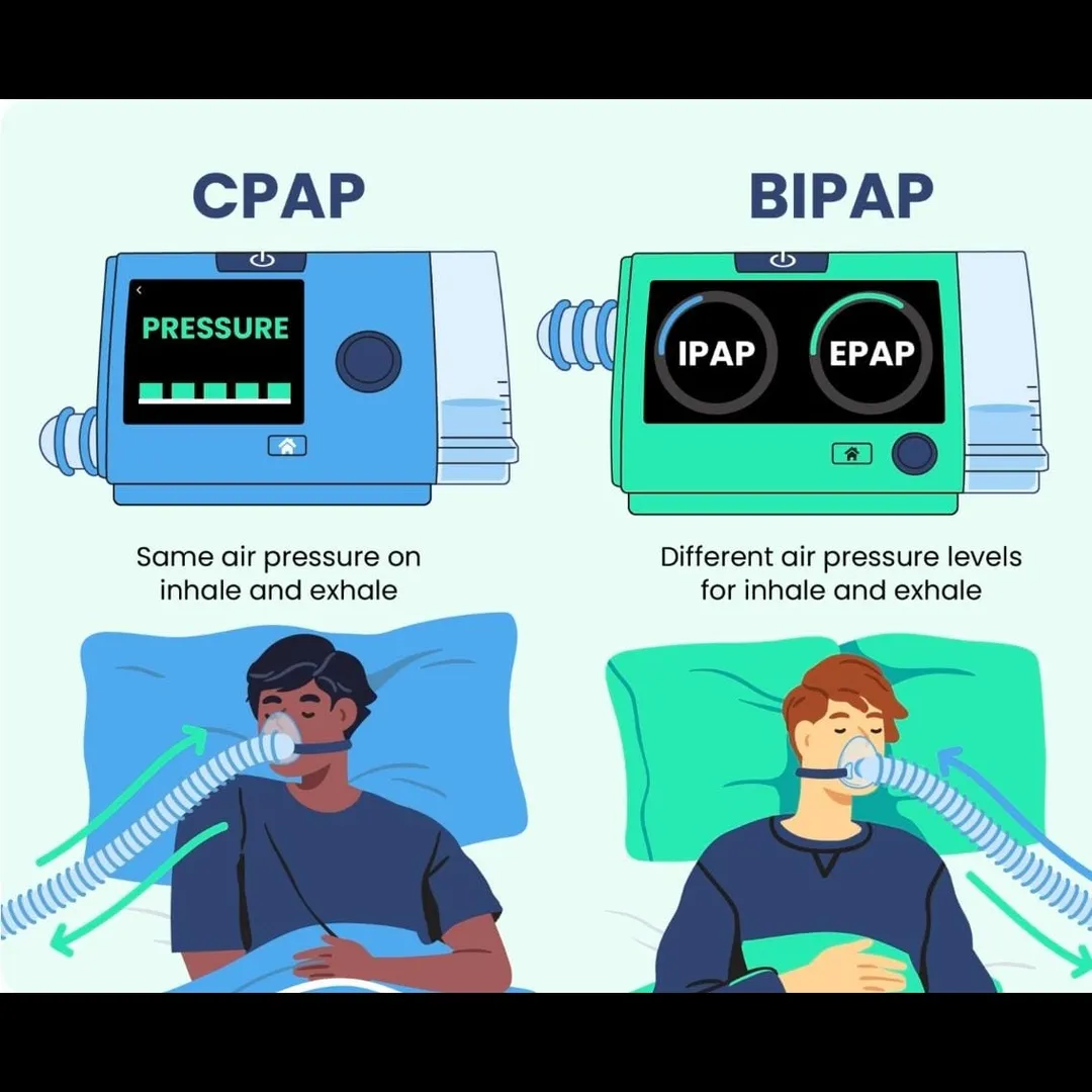 CPAP BIPAP IN CHENNAI