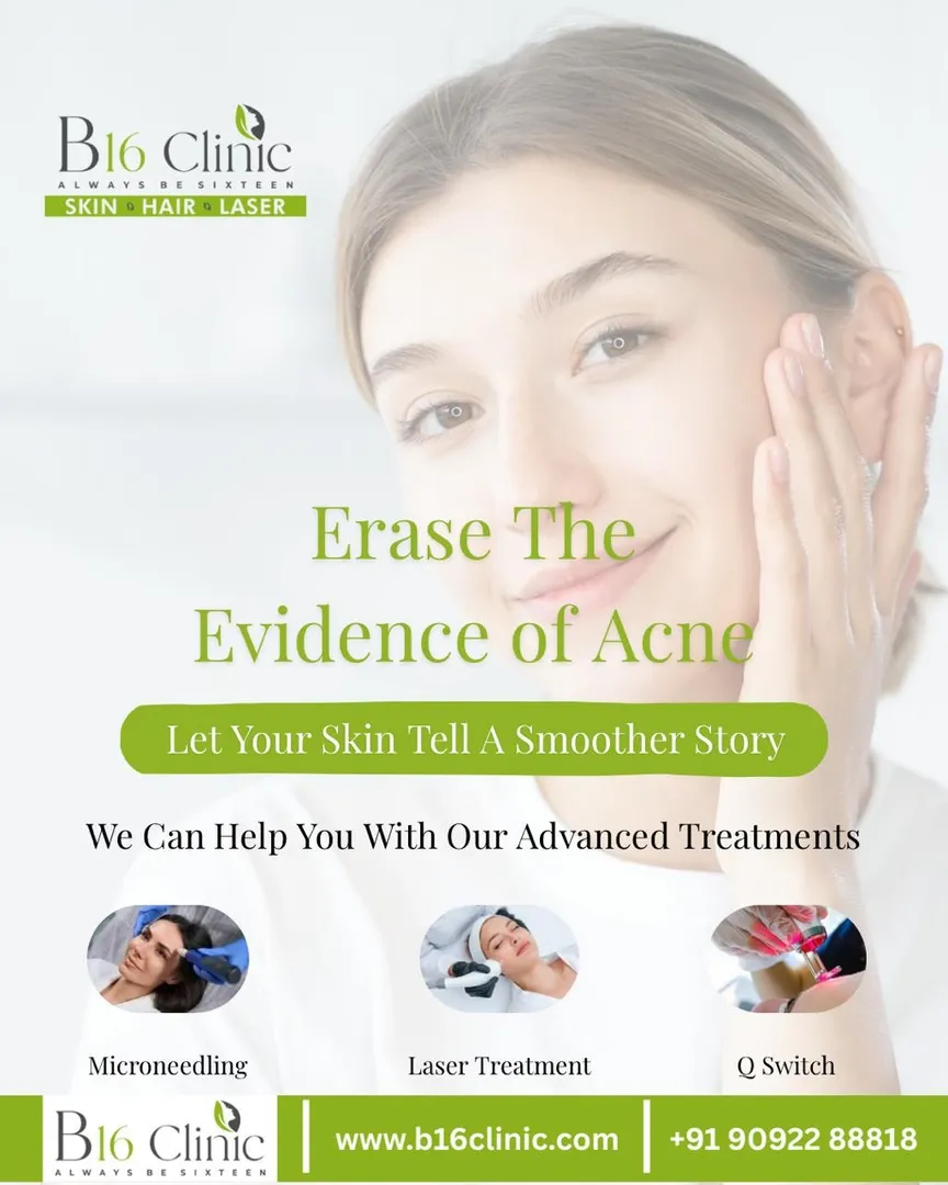 B16 Clinic β Best Acne Treatment Clinic in Coimbatore πΈβ¨