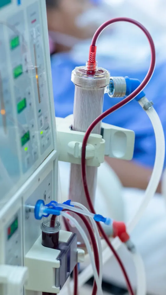 Dialysis Products in Pune – Reliable Supplies for Renal Care