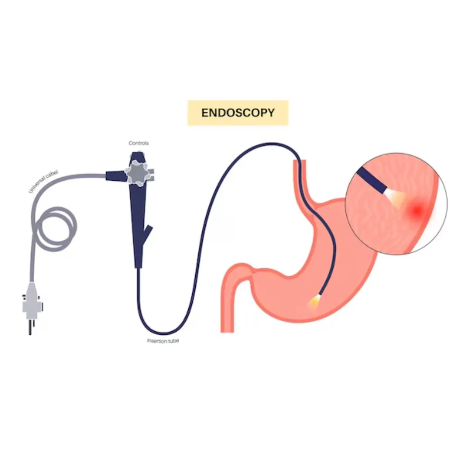 Endoscopy in Punawale