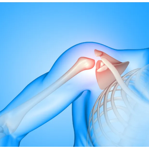 Bankart’s Repair in KR Puram – Preventing Recurrent Shoulder Dislocations