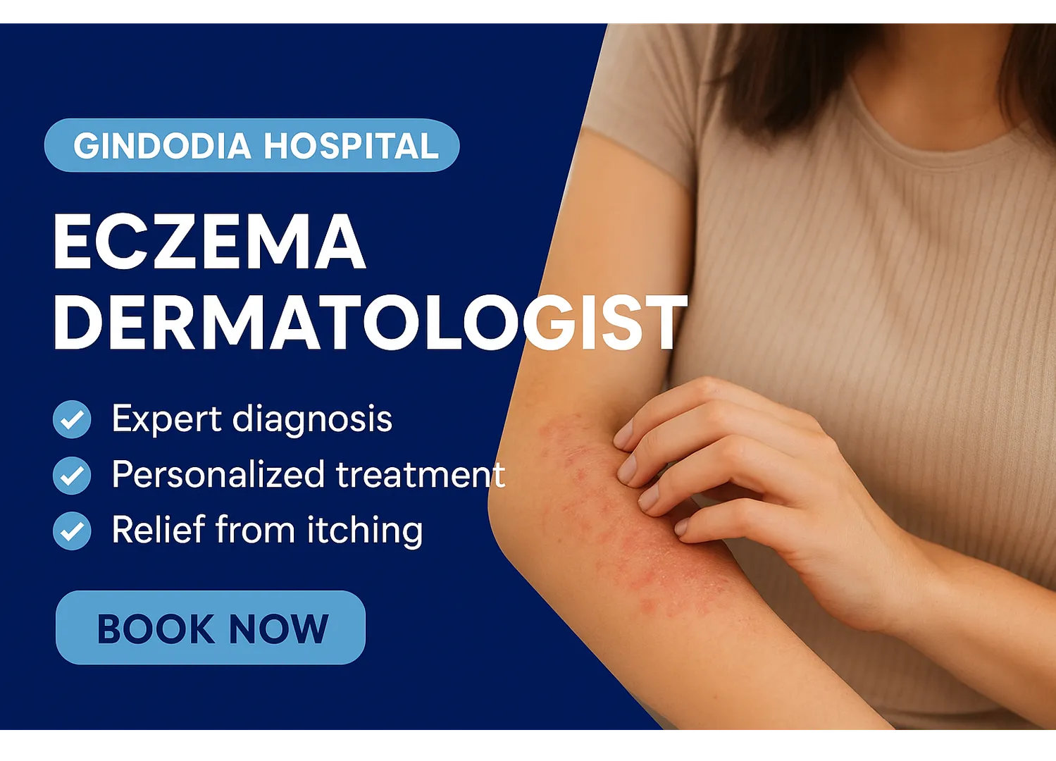 Gindodia Hospital – Expert Eczema Dermatologist in Dhule
