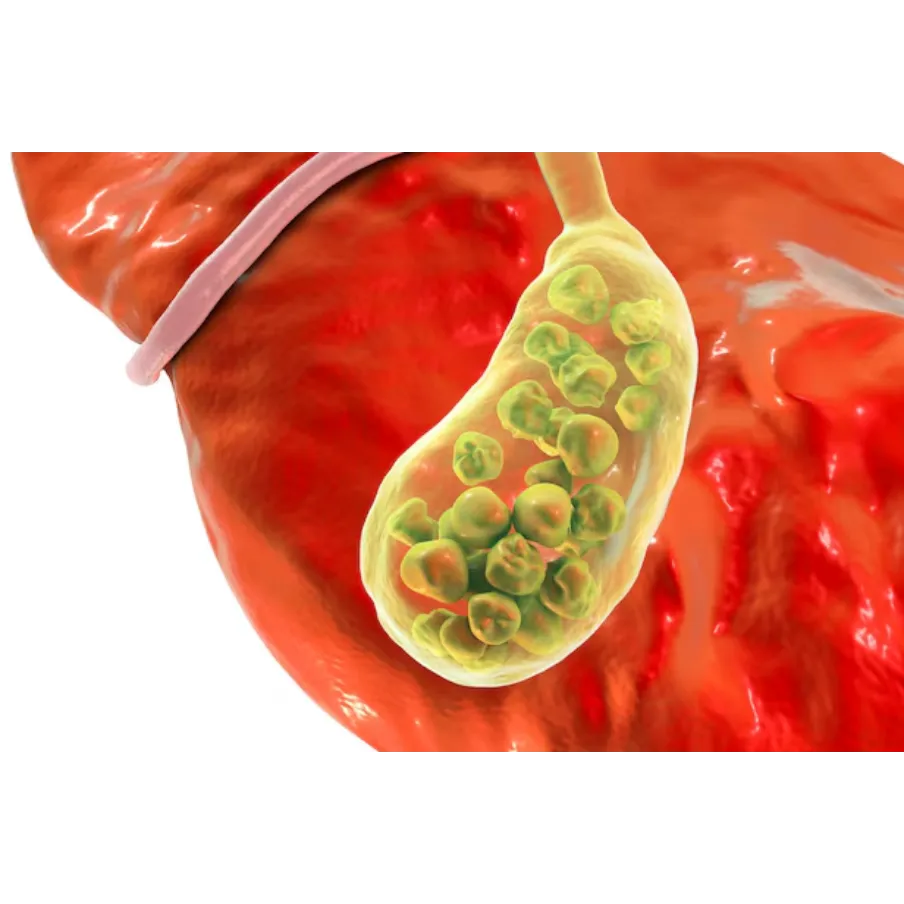 Gall Bladder Stone Treatment in Pimple Nilakh