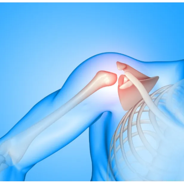 Reverse Shoulder Replacement in Bangalore