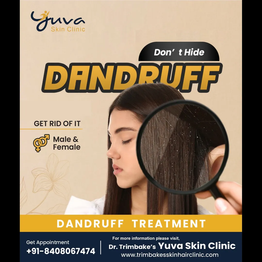 Dandruff is the excess shedding of the top layer of the skin on the scalp, eyebrows or along the sid...