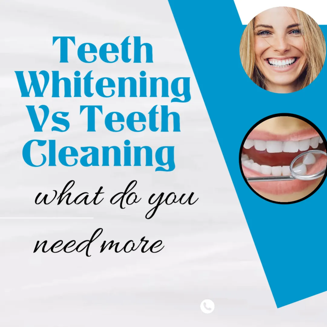 Teeth Cleaning vs Teeth whitening!
What do I need more?