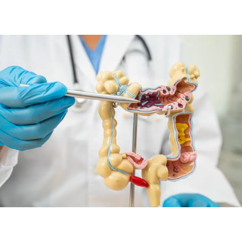 Appendix Removal Surgery in Panvel – Quick Relief with Expert Hands
