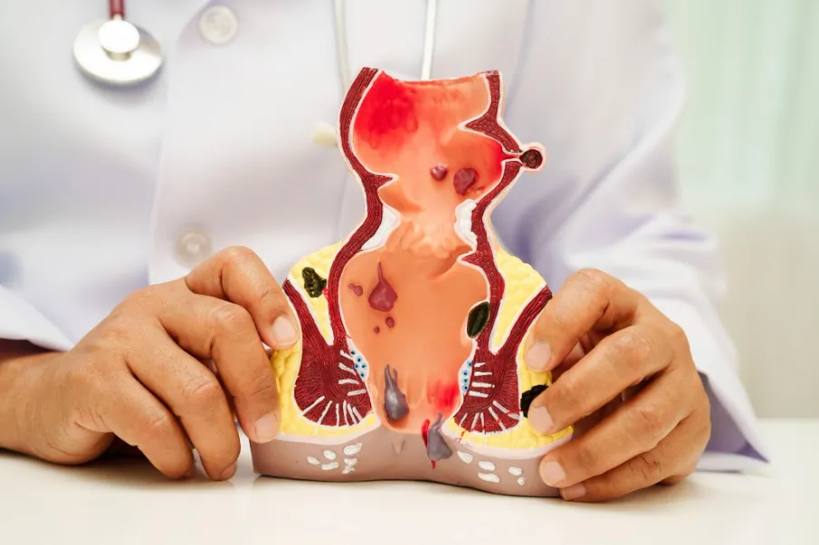 Proctologist in Kalewadi – Specialized Care for Anorectal Conditions