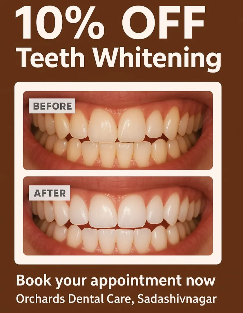 ✨ 10% OFF Teeth Whitening @ Orchards Dental Care ✨