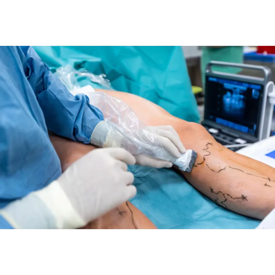 Vascular Surgeon in Pune – Treating Aneurysms and Blood Vessel Disorders
