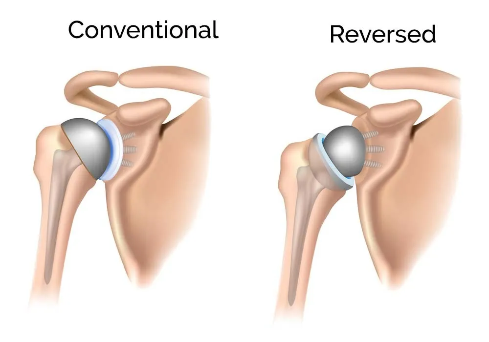 Top Rated Orthopedic Doctor In Delhi NCR