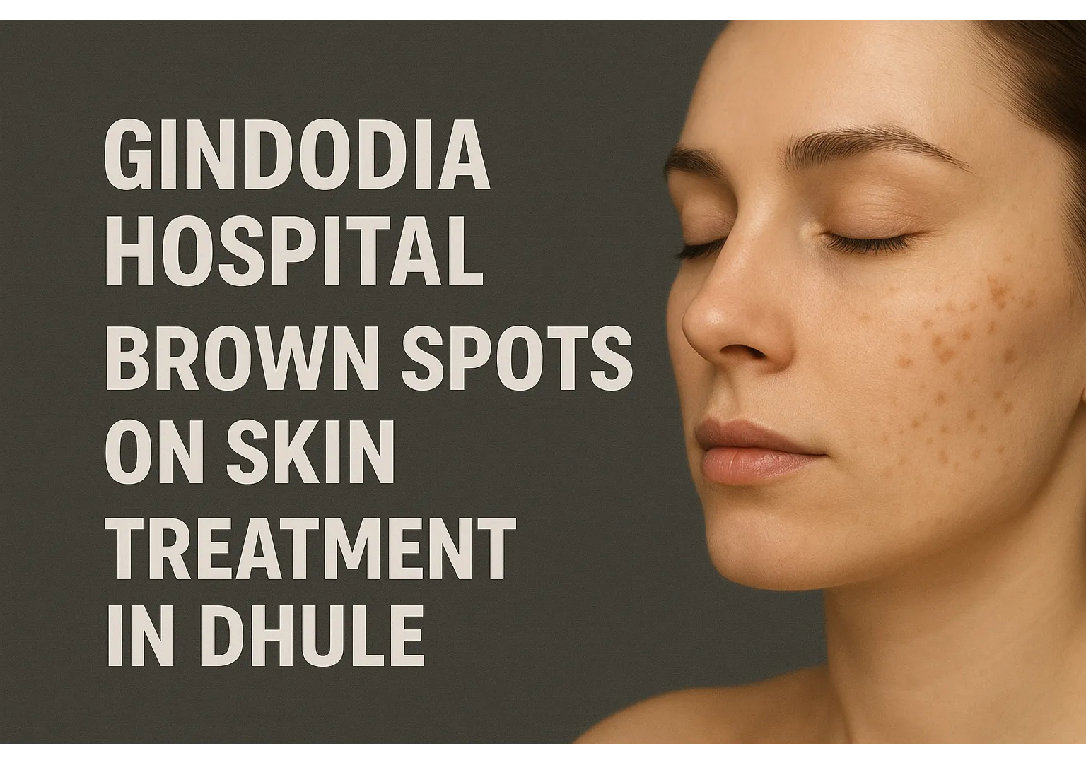 Gindodia Hospital – Brown Spots on Skin Treatment in Dhule