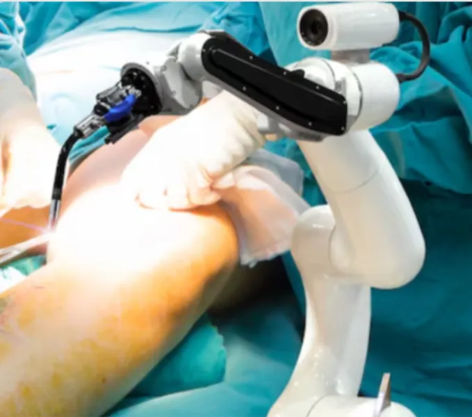 Robotic Knee Replacement in Hebbal