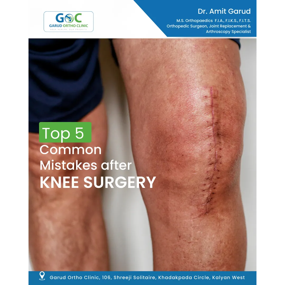 Dr. Amit Garud Kalyan | Orthopedic Surgeon & Post- TKR Surgery Care