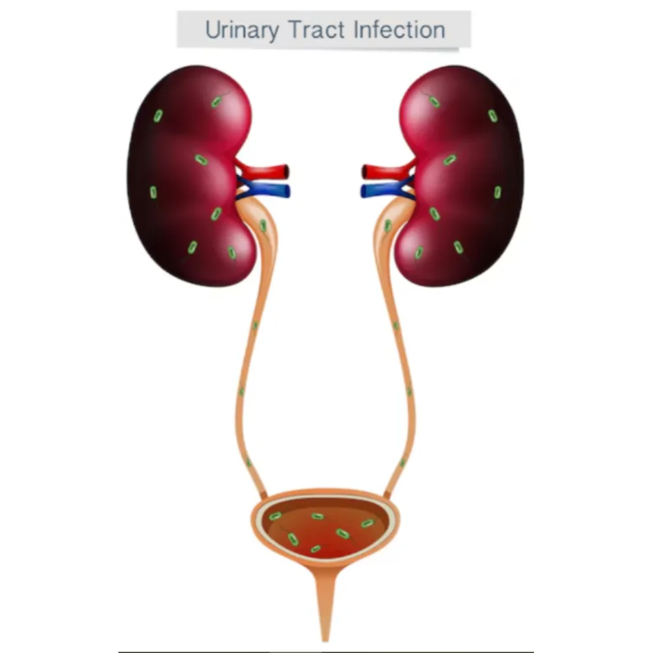 Urinary Infection Treatment in Thane – Quick and Effective Relief